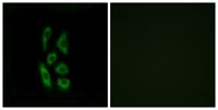 ACOT12 Polyclonal Antibody