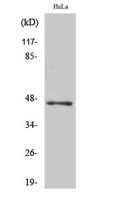 ACOT4 Polyclonal Antibody