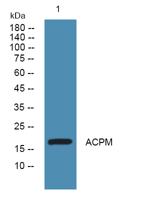 ACPM Polyclonal Antibody