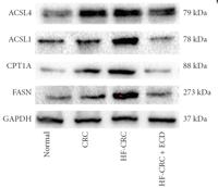 ACSL1 Polyclonal Antibody