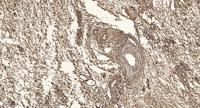 SCAF1 Polyclonal Antibody