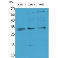 SCP-3 Polyclonal Antibody