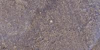 SDHA Polyclonal Antibody