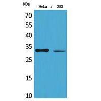 SDHB Polyclonal Antibody
