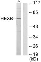 Hexb Polyclonal Antibody