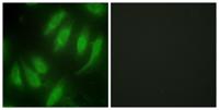 Hexim1 Polyclonal Antibody