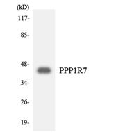 Sds22 Polyclonal Antibody