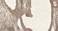 Sds22 Polyclonal Antibody
