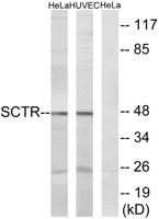 Secretin Receptor Polyclonal Antibody