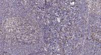 Secretin Receptor Polyclonal Antibody