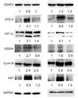 HIF-1α Polyclonal Antibody