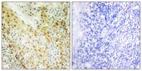 HIRA Polyclonal Antibody