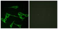 Histamine H2 Receptor Polyclonal Antibody