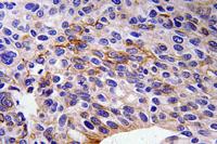 SEMA3A Polyclonal Antibody
