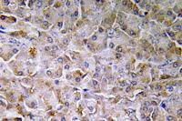 SEMA3C Polyclonal Antibody