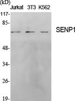 SENP1 Polyclonal Antibody