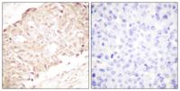SENP1 Polyclonal Antibody