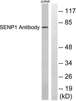 SENP1 Polyclonal Antibody