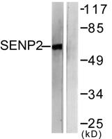 SENP2 Polyclonal Antibody