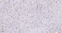 SENP2 Polyclonal Antibody