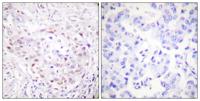 SENP3 Polyclonal Antibody