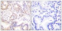 SENP5 Polyclonal Antibody