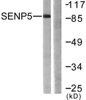SENP5 Polyclonal Antibody