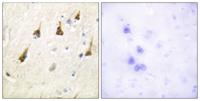 SENP7 Polyclonal Antibody