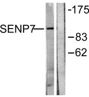 SENP7 Polyclonal Antibody
