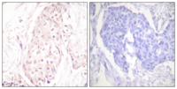 SENP8 Polyclonal Antibody