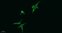 Seprase Polyclonal Antibody