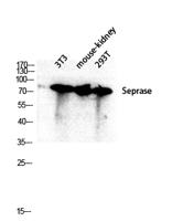 Seprase Polyclonal Antibody