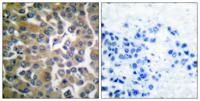 Seprase Polyclonal Antibody
