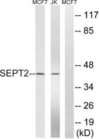 Septin 2 Polyclonal Antibody