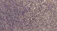 Septin 5 Polyclonal Antibody