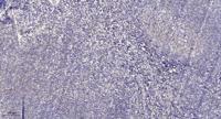Septin 6 Polyclonal Antibody