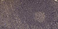 Septin 8 Polyclonal Antibody