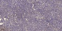Serine racemase Polyclonal Antibody
