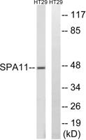Serpin A11 Polyclonal Antibody