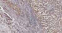 Serpin A11 Polyclonal Antibody