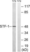 SF-1 Polyclonal Antibody