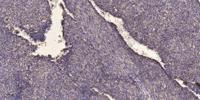 SF-1 Polyclonal Antibody