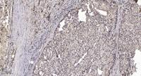 SFRS14 Polyclonal Antibody