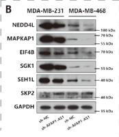 SGK1 Polyclonal Antibody