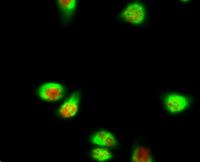 SGK1 Polyclonal Antibody