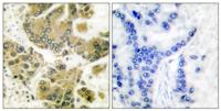SGK1 Polyclonal Antibody