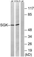 SGK1 Polyclonal Antibody