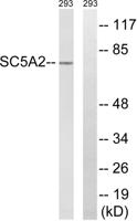 SGLT-2 Polyclonal Antibody