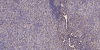 SGLT-2 Polyclonal Antibody