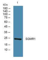 SGMR1 Polyclonal Antibody